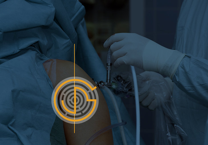 arthroscopic shoulder surgery