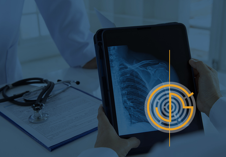 open shoulder surgery image